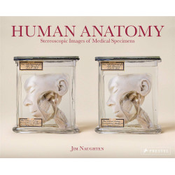 Human Anatomy: Stereoscopic Images of Medical Specimens