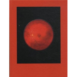 Mikhael Subotzky: Retinal Shift