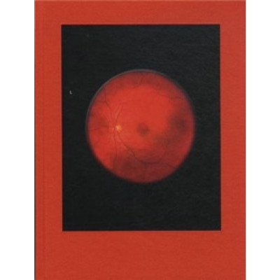 Mikhael Subotzky: Retinal Shift